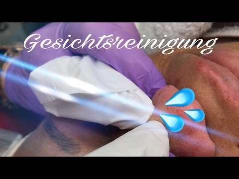 Die lokalisierte Schuppenflechte die Diagnose Die Verschärfung der Schuppenflechte was zu übernehmen,
