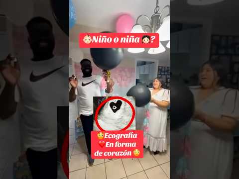 Conociendo el sexo del bebé en las primeras semanas de embarazo #pregenency #pregnant