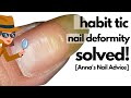 Uneven ridgy thumbnails |  Habit Tic Nail Deformity SOLVED!