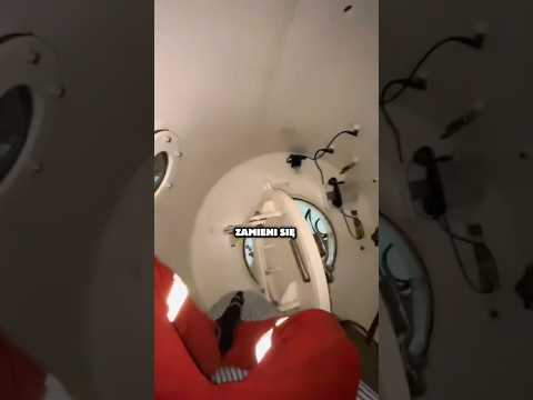 Ten prosty zabieg ratuje im życie 😳