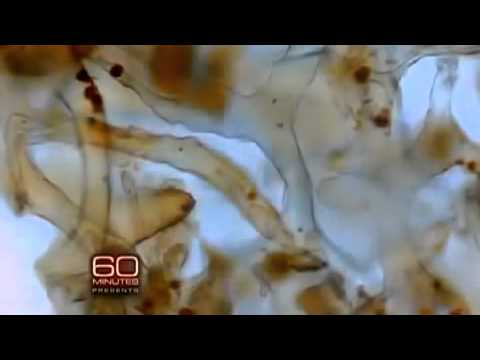 Real dinosaur still-soft biological tissue on ABC's 60 Minutes