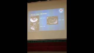 SIÊU ÂM TRONG ĐA THAI BS VŨ