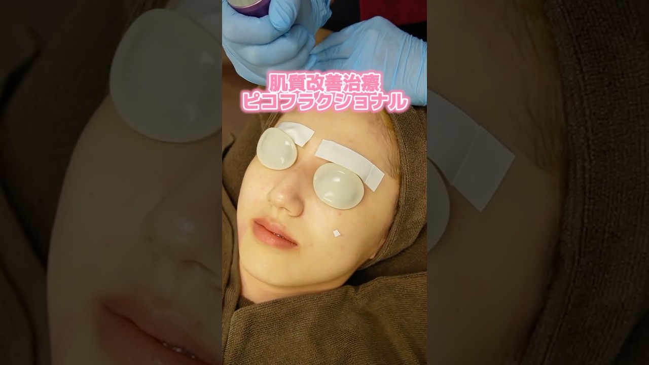 ピコフラクショナル気になったので行ってみた！