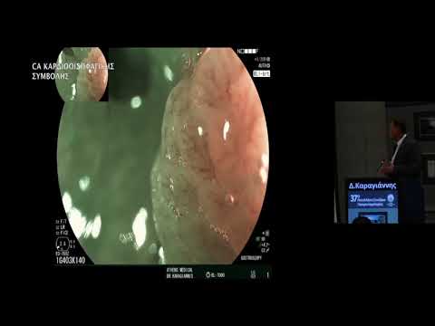 Καραγιάννης Δημήτρης - High resolution microendoscopoy Check up