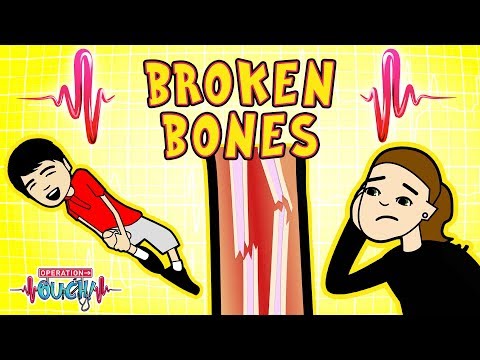 Science for kids | Body Parts - BROKEN BONES | Experiments for kids | Operation Ouch Video