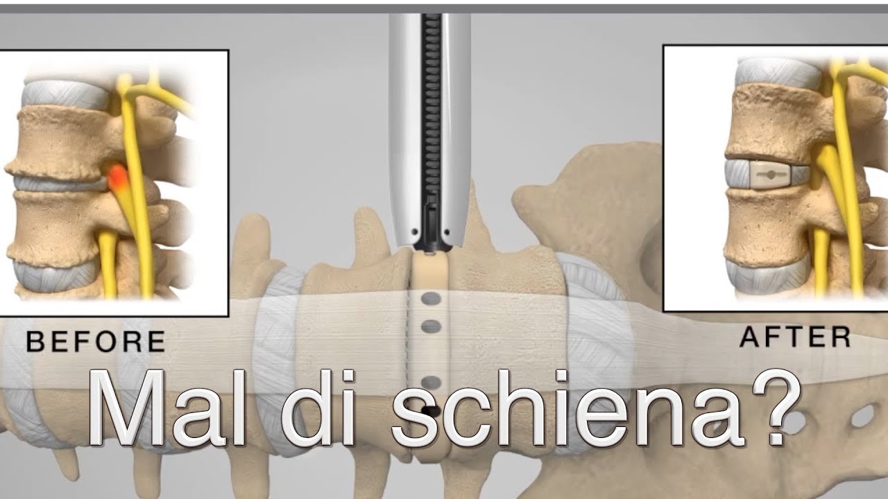 Francesco Caiazzo-14