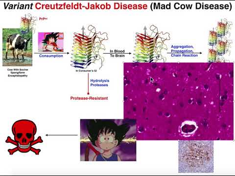 Prions | Mad Cow Disease & Variant Creutzfeldt-Jakob Disease (vCJD)