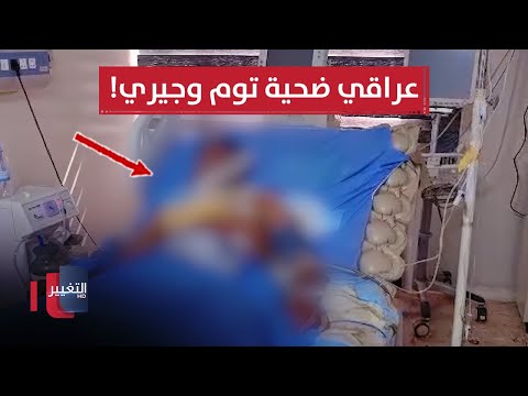 فيديو | هجوم غير متوقع.. عراقي ضحية توم وجيري!