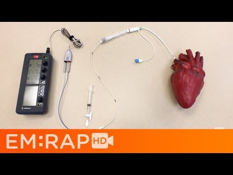 Placing a Transvenous Pacemaker