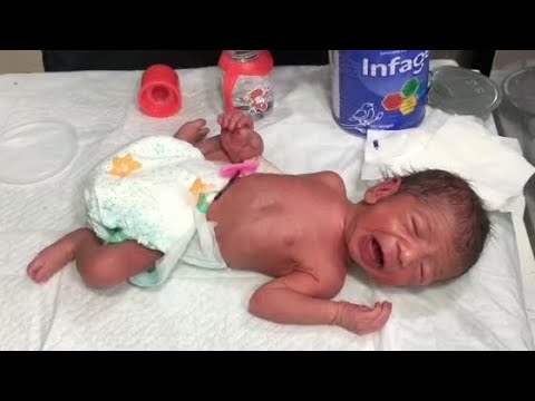 “LBW Newborn First Feeding Trial | NICU Nursing Care & Clinical Support”