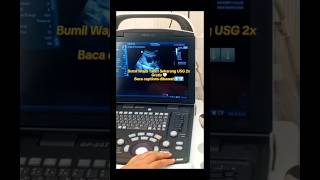 Download lagu Bumil mendapatkan jatah USG gratis 2 kali, yaitu pada TM 1 dan  TM 3 di faskes 1 ya... #bumil #hamil mp3