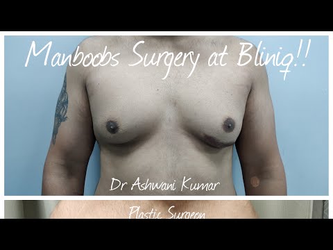 Patient Recovery Case — Video 35 (Tummy Tuck)