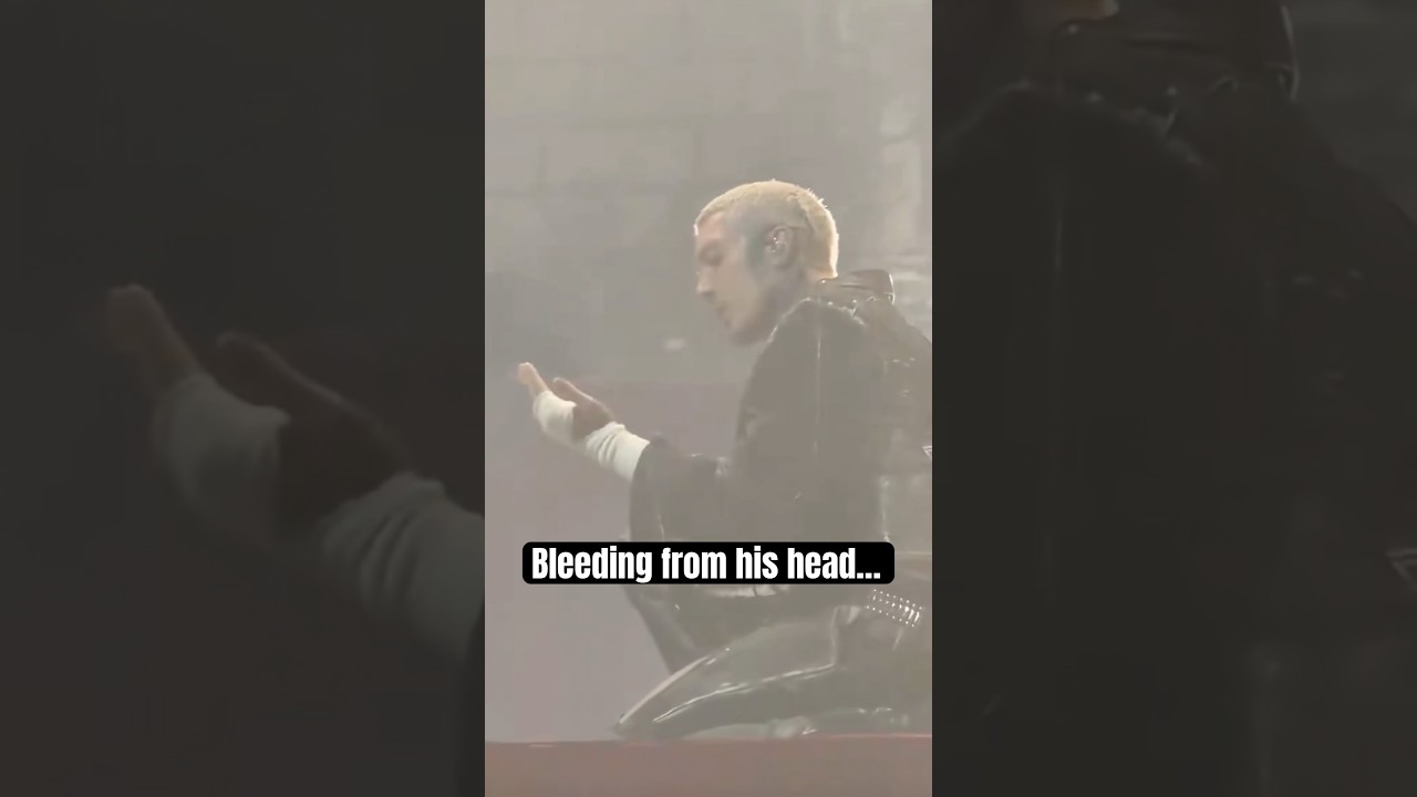 Oli Sykes hit in the head by phone at BMTH causing injury 🤦&zwj;♂️ #bringmethehorizon #bmth #concert - YouTube