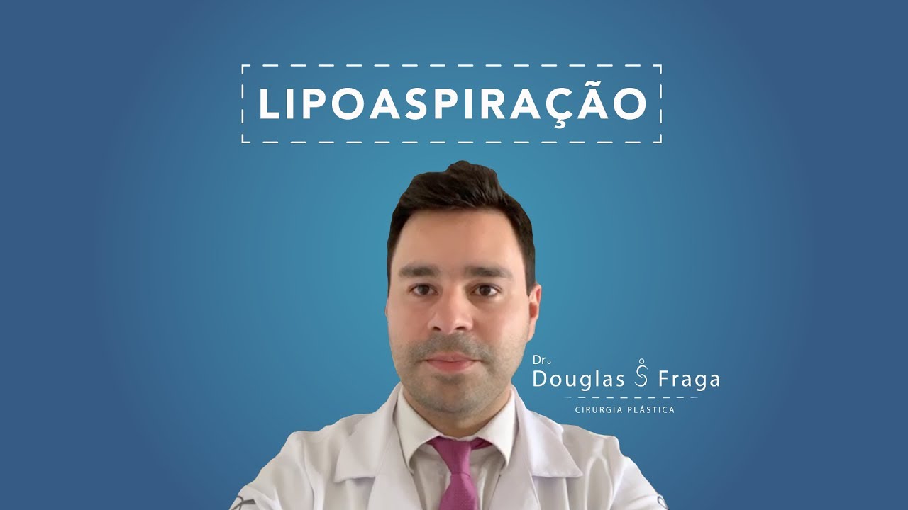 Douglas Severo Fraga-10