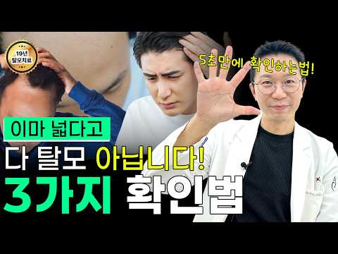넓은 이마? 탈모? 5초면 구분됩니다. (3가지 방법, 병원 가야 하는 신호)