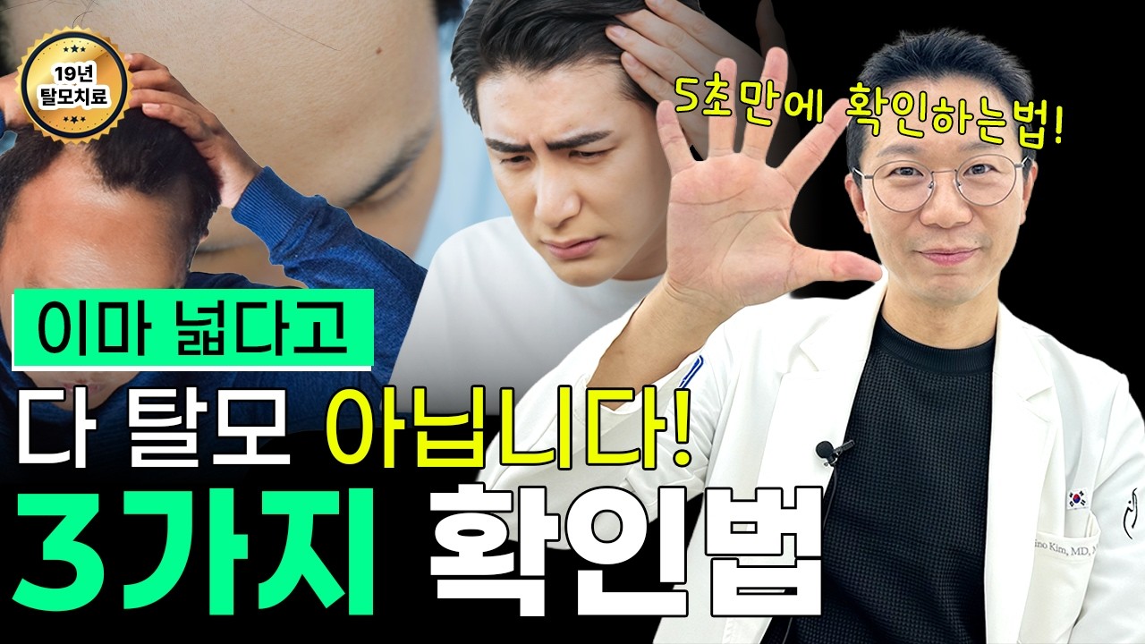  넓은 이마? 탈모? 5초면 구분됩니다. (3가지 방법, 병원 가야 하는 신호)