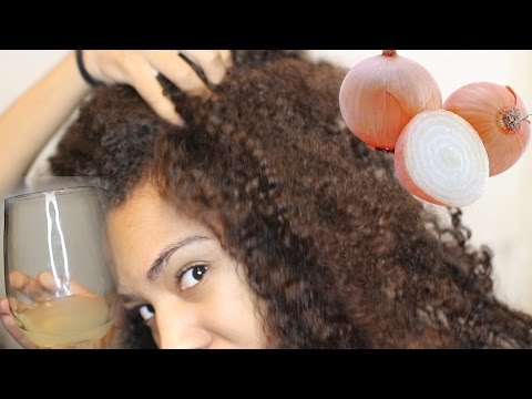 How To GROW HAIR Fast! Onion Juice for Rapid Hair Growth & Health Scalp! Natural Hair Video