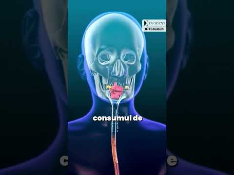 Care sunt etapele tratamentului?