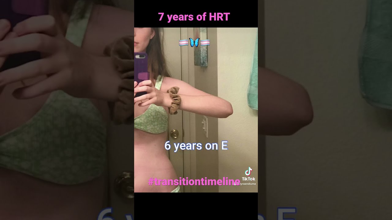 MTF transition 7 years