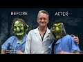 Which Witch A HALLOWEEN TRANSFORMATION Plastic Surgeon Dr Katzen Beverly Hills