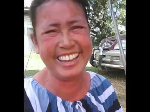 ประวัติโรคผิวหนังภูมิแพ้ ไม่ครีมกลาก