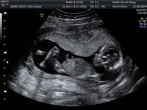 I'm so pregnant - Parody (Fancy-Iggy)