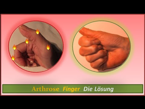 Angeborene Hüftluxation Behandlung Schreckliche Rückenschmerzen während der Menstruation