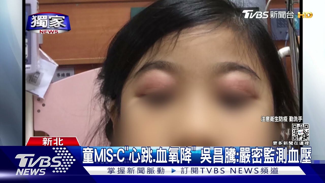 7歲女貝貝「MIS-C燒41.3度」 父憂:再也說不到話