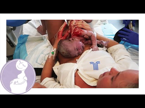 Min perfekta förlossning *Känsliga tittare varnas* - Victoria Törnegren