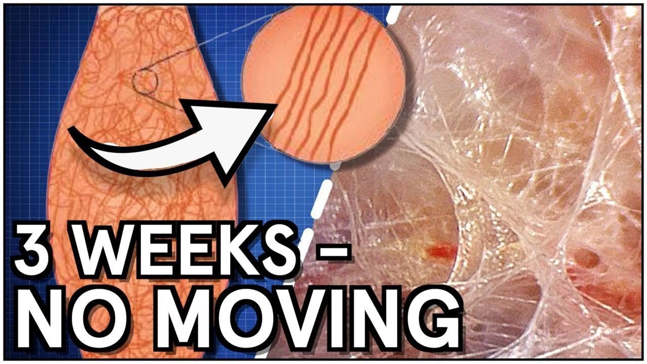 This is Why I Stretch EVERY DAY (Fascia Documentary)