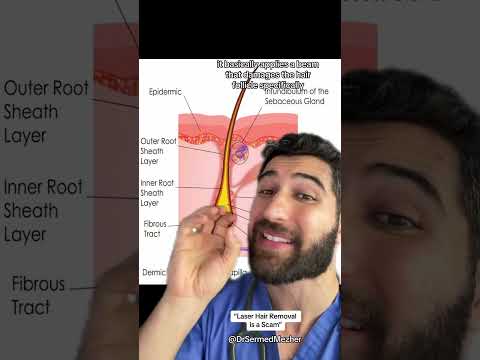 “Laser Hair Removal is a Scam” #wait