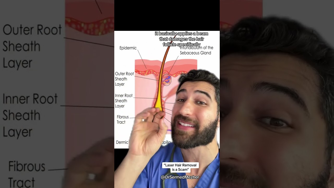 “Laser Hair Removal is a Scam” #wait