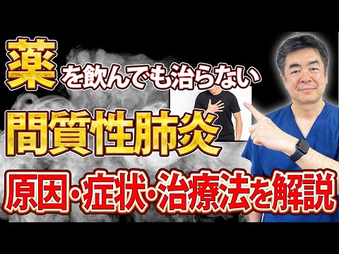 【美空ひばりも八代亜紀も】間質性肺炎とは？原因・症状・治療法を医師が解説