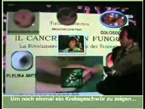 Wie ich selbst Prostata-Massage tun und cum Prostaplant Medikamente oder Nahrungsergänzungsmittel