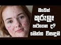 piyum-vila-pimples-09-07-2018