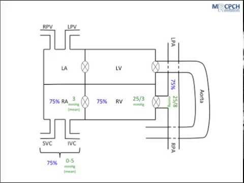 Interpreting Cardiac Catheterisation Data