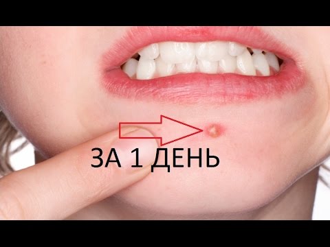 Капилляры и пигментные пятна Milk skin отбеливающий крем купить в екатеринбурге