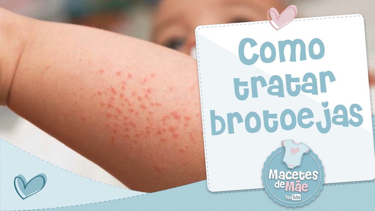 COMO TRATAR BROTOEJA - MACETES DE MÃE