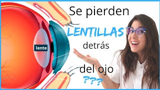 Se PIERDEN las LENTILLAS detrás del ojo  || centro óptico LAS ARTES