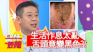 生活作息太亂，舌頭竟變黑色？！【醫師好辣】20200903 part1 EP1009 劉雨柔 宋晏仁