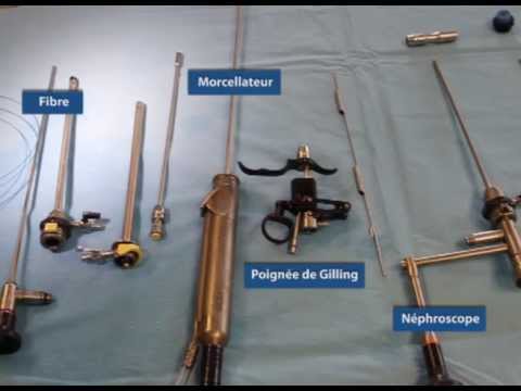 Absud aus der Rinde von Espe mit BPH Preis Behandlung von Prostatitis