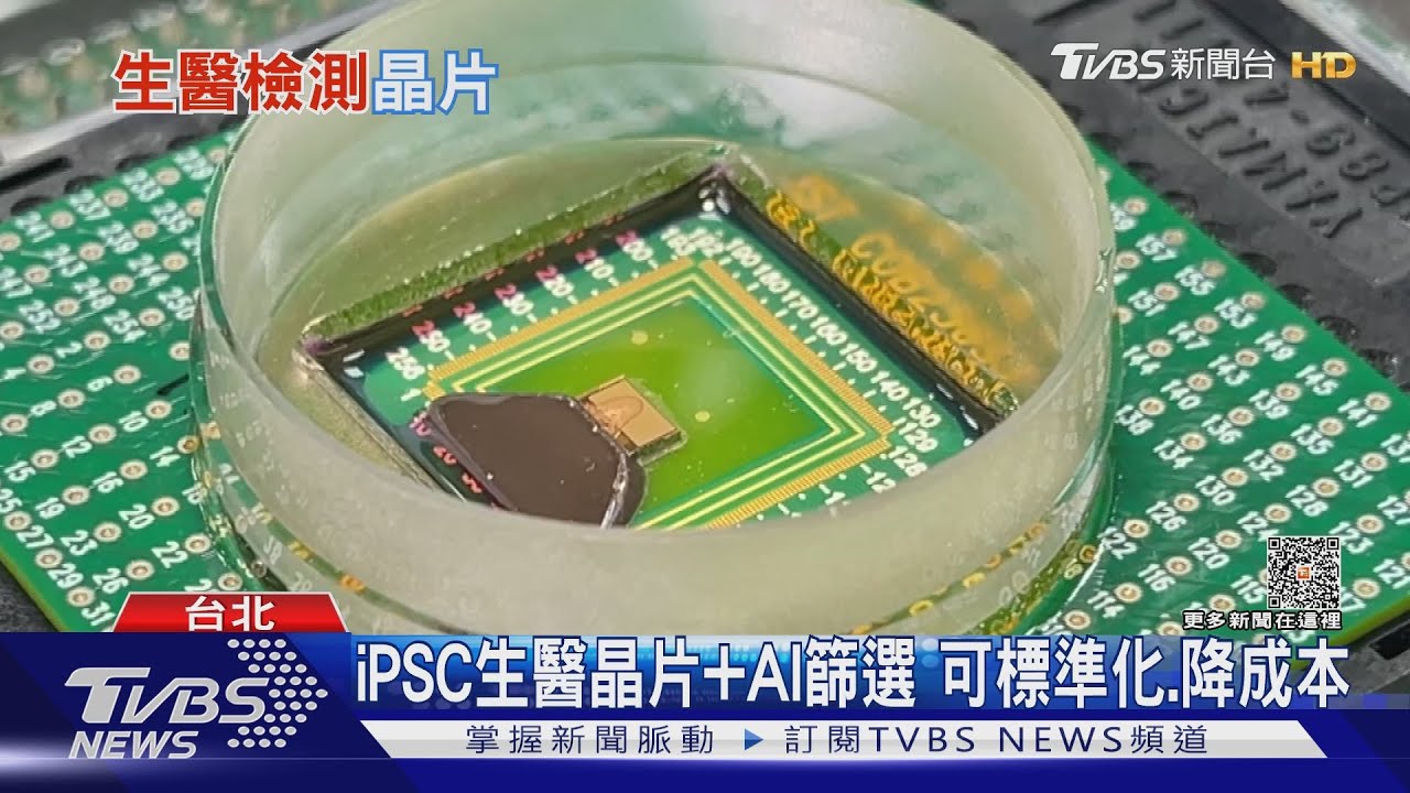 AI助重見光明 北榮陽交聯手台積電救患者