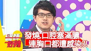 發燒多日、口腔塞滿膿，連胸口都遭感染？！【醫師好辣】20200427 part2 EP934 陳榮堅 趙國翔