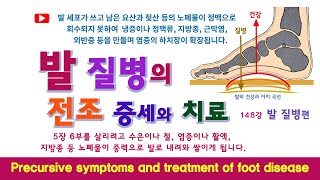 발 질병 148강. 발에 생기는 질병의 전조 증세와 치료. Precursive symptoms and treatment of foot disease.