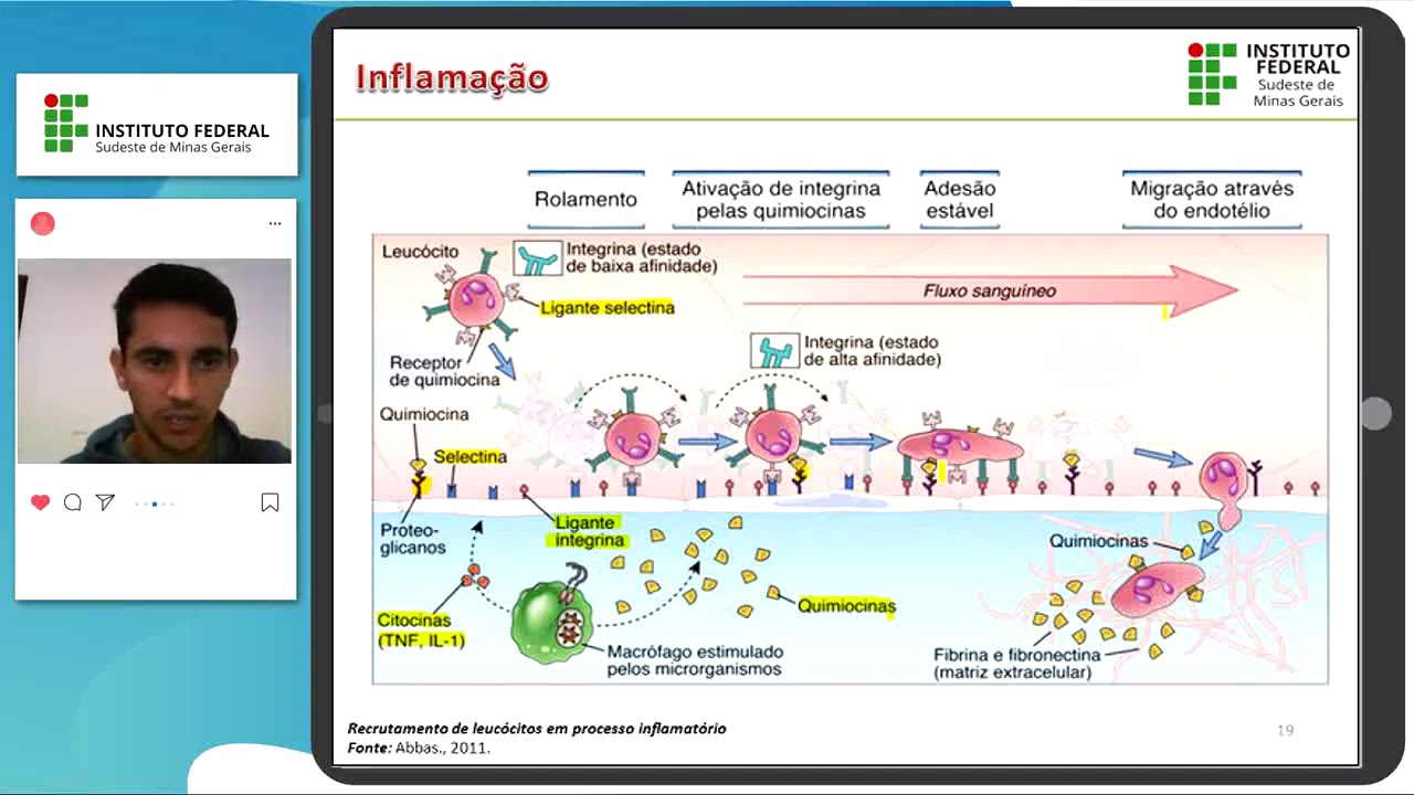 Imunidade Inata - Inflamação