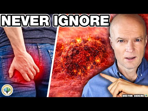 10 Early Colon Cancer Signs You Should Never Ignore