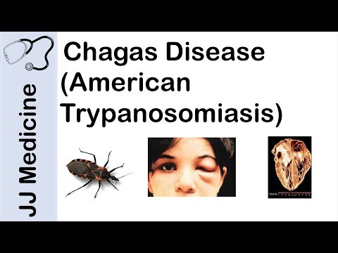 Chagas Disease | American Trypanosomiasis | Causes, Symptoms and Treatment