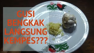 Download lagu How to Quickly Treat Swollen Gums – Enough With These Two Ingredients Swollen Gums Deflated mp3