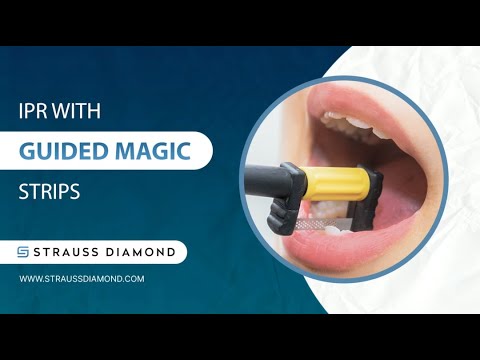 How to Perform IPR with Our New Guided Magic Strip System - Strauss Diamond