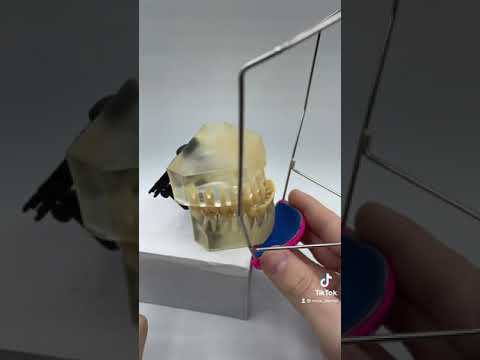 Orthodontic Headgear for Class 3 ( Underbite)